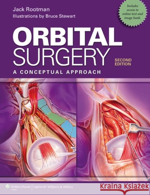 Orbital Surgery: A Conceptual Approach Rootman, Jack 9781451100105 LIPPINCOTT WILLIAMS & WILKINS