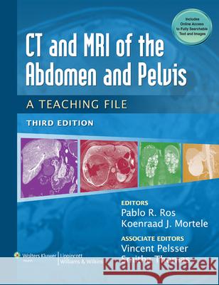 CT & MRI of the Abdomen and Pelvis: A Teaching File Ros, Pablo R. 9781451113525 0