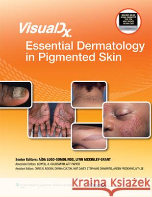Visualdx: Essential Dermatology in Pigmented Skin Goldsmith, Lowell A. 9781451116052 0