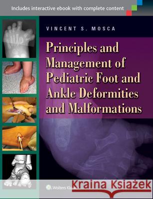 Principles and Management of Pediatric Foot and Ankle Deformities and Malformations Vincent Mosca 9781451130454 Lippincott Williams & Wilkins