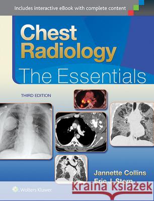 Chest Radiology: The Essentials Janette Collins 9781451144482 Lippincott Williams & Wilkins
