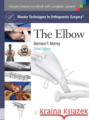 Master Techniques in Orthopaedic Surgery: The Elbow Bernard F. Morrey 9781451173093