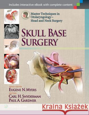 Master Techniques in Otolaryngology - Head and Neck Surgery: Skull Base Surgery Carl Snyderman Paul Gardner 9781451173628