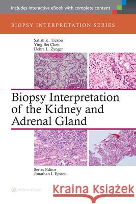 Biopsy Interpretation of the Kidney & Adrenal Gland Tickoo 9781451176476 Lippincott Williams & Wilkins
