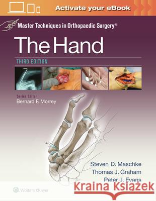 Master Techniques in Orthopaedic Surgery: The Hand Thomas J. Graham 9781451182781 Lww