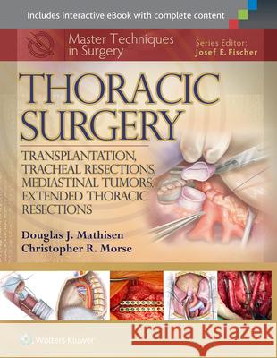 Master Techniques in Surgery: Thoracic Surgery: Transplantation, Tracheal Resections, Mediastinal Tumors, Extended Thoracic Resections Mathisen 9781451190724 Lippincott Williams & Wilkins