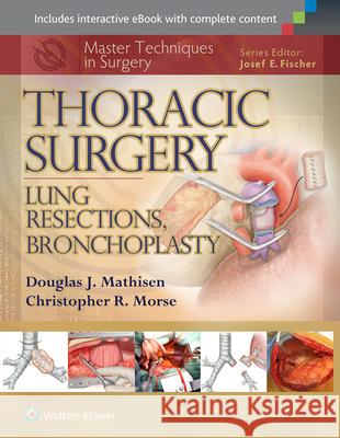 Master Techniques in Surgery: Thoracic Surgery: Lung Resections, Bronchoplasty Mathisen 9781451190731 Lippincott Williams & Wilkins