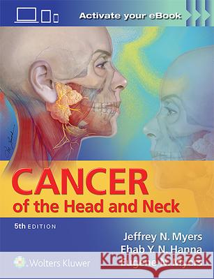Cancer of the Head and Neck Myers, Jeffrey 9781451191134 Lww