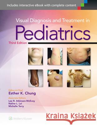 Visual Diagnosis and Treatment in Pediatrics Esther Chung 9781451191189