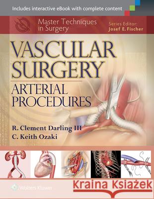 Master Techniques in Surgery: Vascular Surgery: Arterial Procedures R Clement Darling 9781451191615 LIPPINCOTT WILLIAMS & WILKINS
