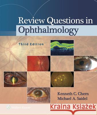 Review Questions in Ophthalmology Kenneth C. Chern 9781451192018 Lippincott Williams & Wilkins