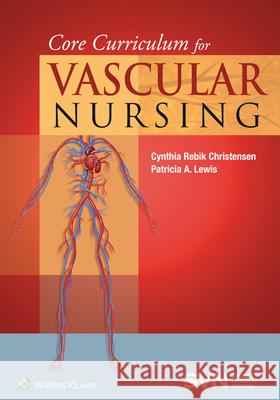 Core Curriculum for Vascular Nursing: An Official Publication of the Society for Vascular Nursing (Svn) Christensen, Cynthia Rebik 9781451192322 Lippincott Williams & Wilkins