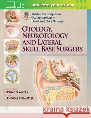 Master Techniques in Otolaryngology - Head and Neck Surgery: Otology, Neurotology, and Lateral Skull Base Surgery J. Thomas Rolan 9781451192506 Lww