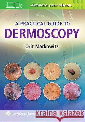 A Practical Guide to Dermoscopy Markowitz 9781451192636