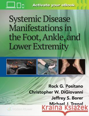 Systemic Disease Manifestations in the Foot, Ankle, and Lower Extremity Jeffrey Borer 9781451192643 Lippincott Williams & Wilkins