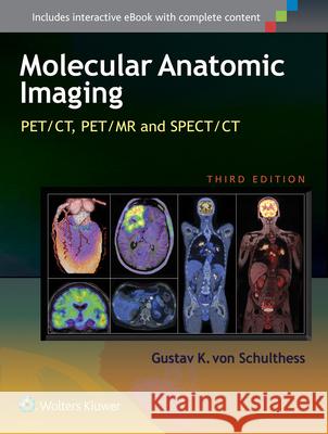 Molecular Anatomic Imaging: Pet/Ct, Pet/MR and Spect CT Gustav K. Vo 9781451192667 Lww