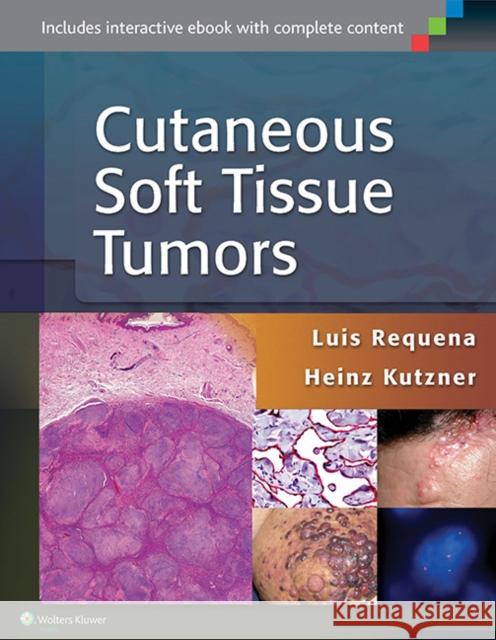 Cutaneous Soft Tissue Tumors Luis Requena Luis Requena Heinz Kutzner 9781451192766 Lippincott Williams & Wilkins