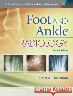 Foot and Ankle Radiology Robert Christman 9781451192834 Lww