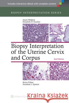 Biopsy Interpretation of the Uterine Cervix and Corpus Anais Malpica Elizabeth D. Euscher 9781451192964 Lippincott Williams and Wilkins