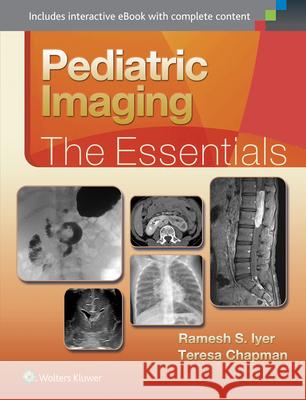 Pediatric Imaging: The Essentials Ramesh Iyer 9781451193176 Lippincott Williams & Wilkins