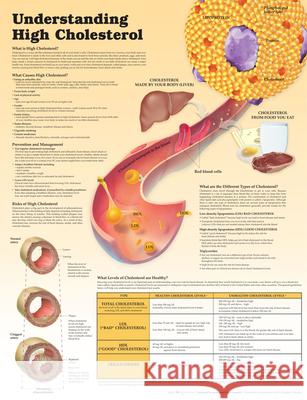 Understanding High Cholesterol Lam Anatomical Chart Company Douglas S. Moodie  9781451193244 Lippincott Williams and Wilkins