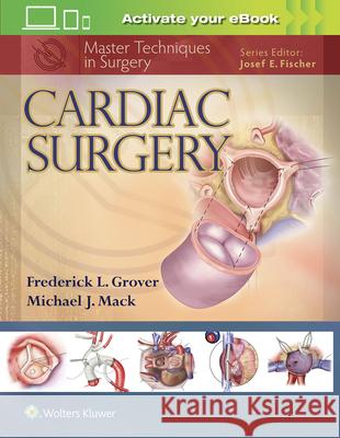Cardiac Surgery Grover, Frederick 9781451193534 LIPPINCOTT WILLIAMS & WILKINS