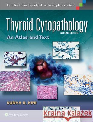 Thyroid Cytopathology: An Atlas and Text Sudha R. Kini 9781451193893 Lww