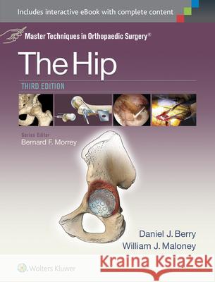 Master Techniques in Orthopaedic Surgery: The Hip Daniel J. Berry William Maloney 9781451194029 Lww