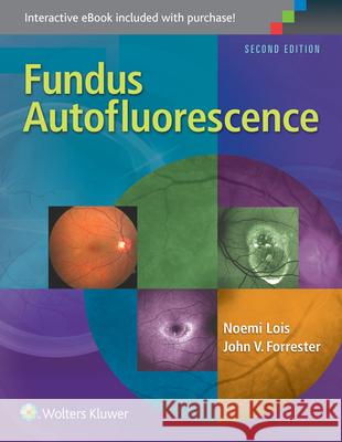 Fundus Autofluorescence Noemi Lois John V. Forrester  9781451194593 Lippincott Williams and Wilkins