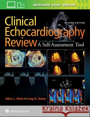 Clinical Echocardiography Review Allan L. Klein 9781451195378