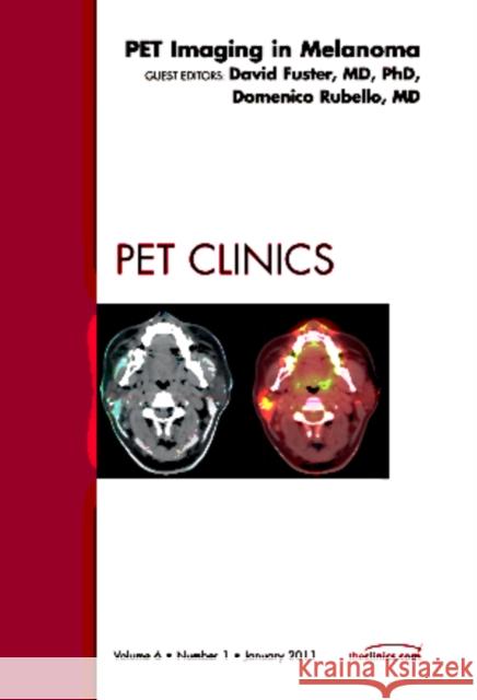 Clinical Applications of Diffusion Imaging of the Brain, an Issue of Neuroimaging Clinics: Volume 21-1 Hygino, Celso 9781455704682