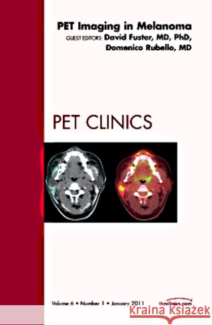 Pet Imaging in Melanoma, an Issue of Pet Clinics: Volume 6-1 Rubello, Domenico 9781455704880