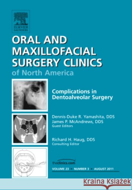 Complications in Dento-Alveolar Surgery, an Issue of Oral and Maxillofacial Surgery Clinics: Volume 23-3 Yamashita, Dennis-Duke R. 9781455710430 Elsevier Saunders