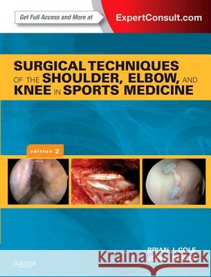 Surgical Techniques of the Shoulder, Elbow, and Knee in Sports Medicine : Expert Consult - Online and Print Brian J., Ed. Cole Jon K. Sekiya 9781455723560