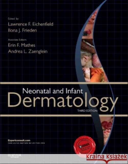 Neonatal and Infant Dermatology Lawrence Eichenfield 9781455726387 Elsevier Saunders