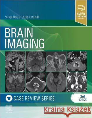 Brain Imaging Case Review Laurie Loevner 9781455774852 Elsevier Health Sciences
