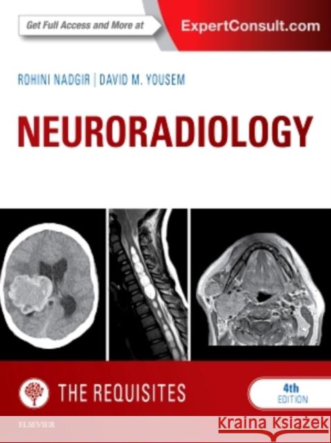 Neuroradiology: The Requisites Rohini Nadgir David M. Yousem 9781455775682 Elsevier