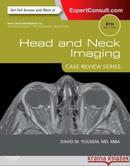 Head and Neck Imaging: Case Review Series David M. Yousem 9781455776290 W.B. Saunders Company