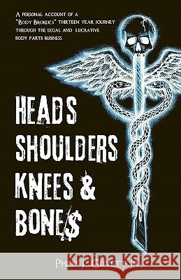 Heads, Shoulders, Knees and Bone$: A personal account of a 