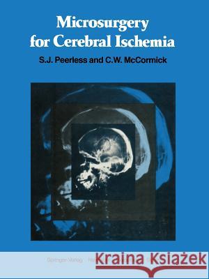 Microsurgery for Cerebral Ischemia S. J. Peerless C. W. McCormick 9781461260929 Springer