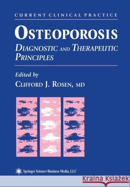 Osteoporosis: Diagnostic and Therapeutic Principles Rosen, Clifford J. 9781461266686