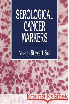 Serological Cancer Markers Stewart Sell 9781461267454 Humana Press