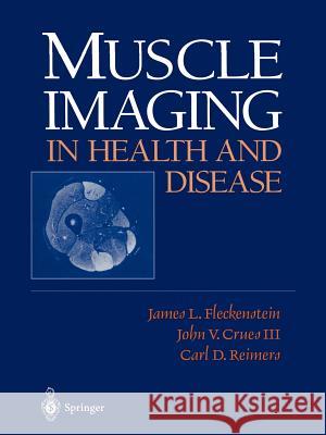Muscle Imaging in Health and Disease James L. Fleckenstein John V. III Crues C. D. Reimers 9781461274988 Springer