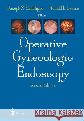Operative Gynecologic Endoscopy Joseph S. Sanfilippo Roland L. Levine B. J. Masterson 9781461275053 Springer