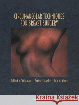 Circumareolar Techniques for Breast Surgery Tolbert S. Wilkinson Adrien E. Aiache Luiz S. Toledo 9781461275657