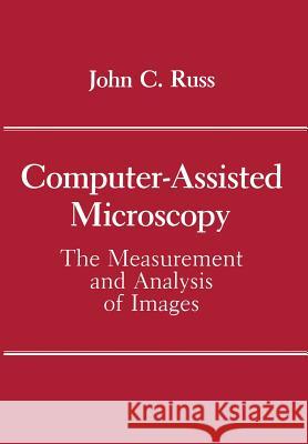 Computer-Assisted Microscopy: The Measurement and Analysis of Images Russ, John C. 9781461278689 Springer