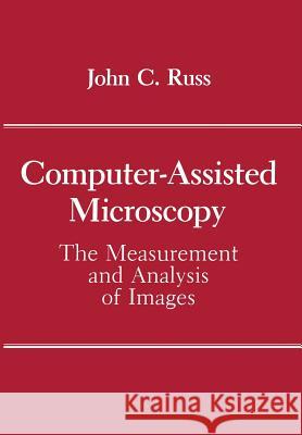 Computer-Assisted Microscopy: The Measurement and Analysis of Images Russ, John C. 9781461278689