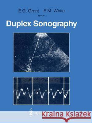 Duplex Sonography Edward G. Grant E. Maureen White 9781461283331