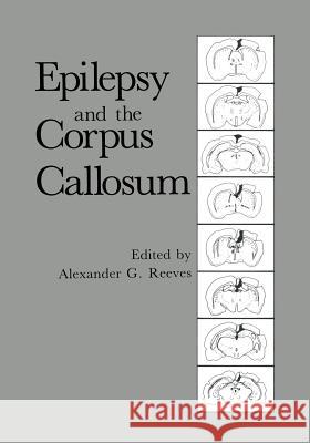 Epilepsy and the Corpus Callosum Alexander G. Reeves 9781461294733 Springer