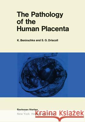 The Pathology of the Human Placenta Kurt Benirschke 9781461298113